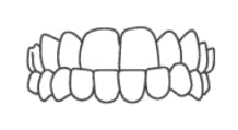 Autres cas orthodontie
