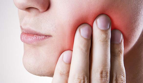 Guide sur les dents de sagesse : Symptômes, opération et cicatrisation