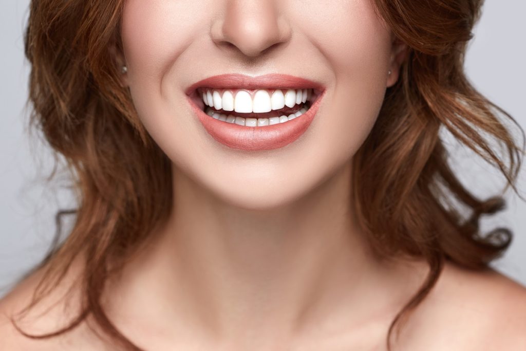 hollywood smile orthodontie dentiste dentaire facettes ou orthodontie bagues gouttières paris 2