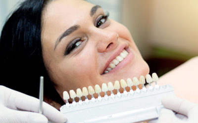 Hollywood Smile : orthodontie ou facettes par quoi commencer ?