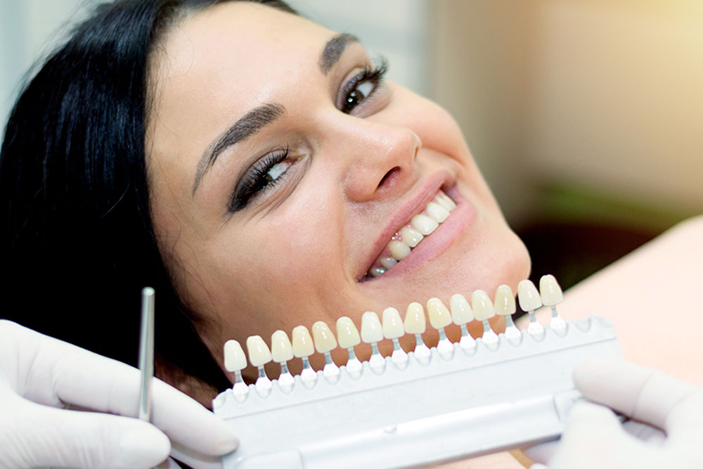 Hollywood Smile : orthodontie ou facettes par quoi commencer ?